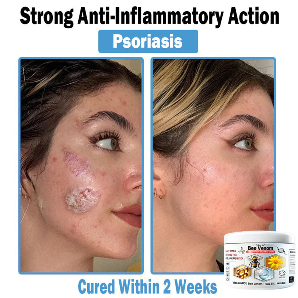 Trilumia® Bee Venom Multi-Symptom Skin Treatment Cream(👨‍⚕ Recommended by the British Association of Dermatologists – BAD) ⏰50% Off for a Limited Time – Sponsored by Boots